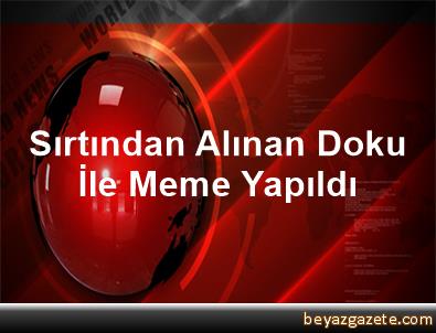 Sirtindan Alinan Doku Ile Meme Yapildi Sanliurfa